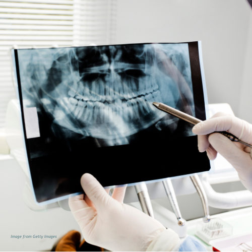 AI Dentistry